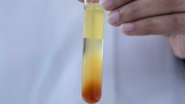 Emulsions- & Suspensionsanalyse